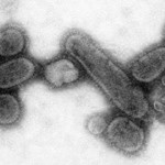 Mexican swine flu will kill us all, they think. Maybe.